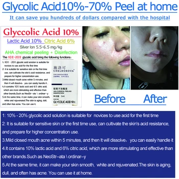 Glikolik Asit 20% 30% 35% 40% 50% 60% 70% Vücut Akne izleri için Yüz için Kimyasal Soyma Exfoliator Cilt Beyazlatma Cilt Yaşlanmasını İzler