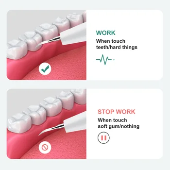 Ultrasonik Diş Ölçekleyici Elektrikli Taş Leke Calculus Plak Temizleme Diş Beyazlatma Tartar Eliminator Kazıyıcı Diş Hekimliği Araçları